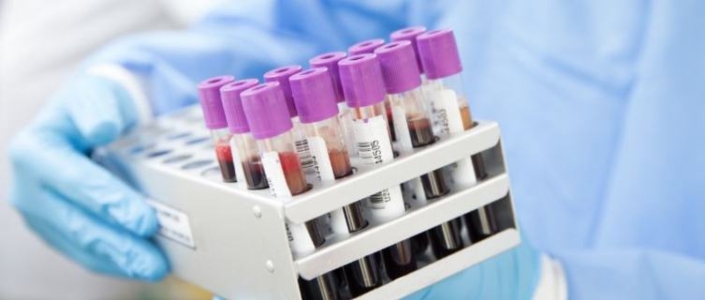 Largest blood supply nonprofit in the midwest increases donations with on-demand bilingual services